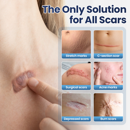 🔥Last Day Discount🔥 LOVILDS® Texture Repair Gel