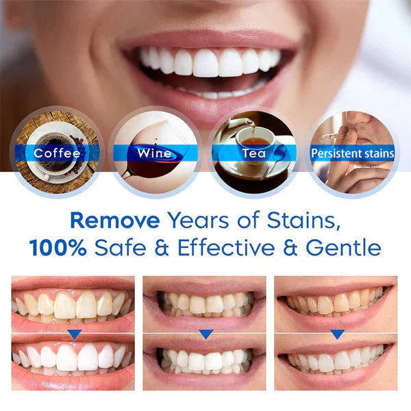 SmileFitPro™ Teeth Whitening Essence