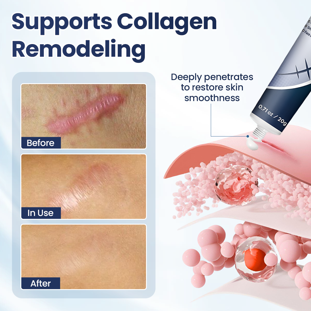 🔥Last Day Discount🔥 LOVILDS® Texture Repair Gel