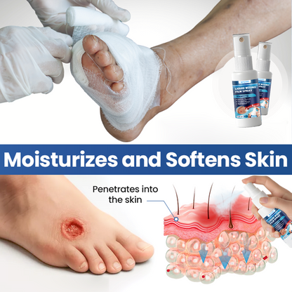 NESLEMY® Liquid Wound Film Spray